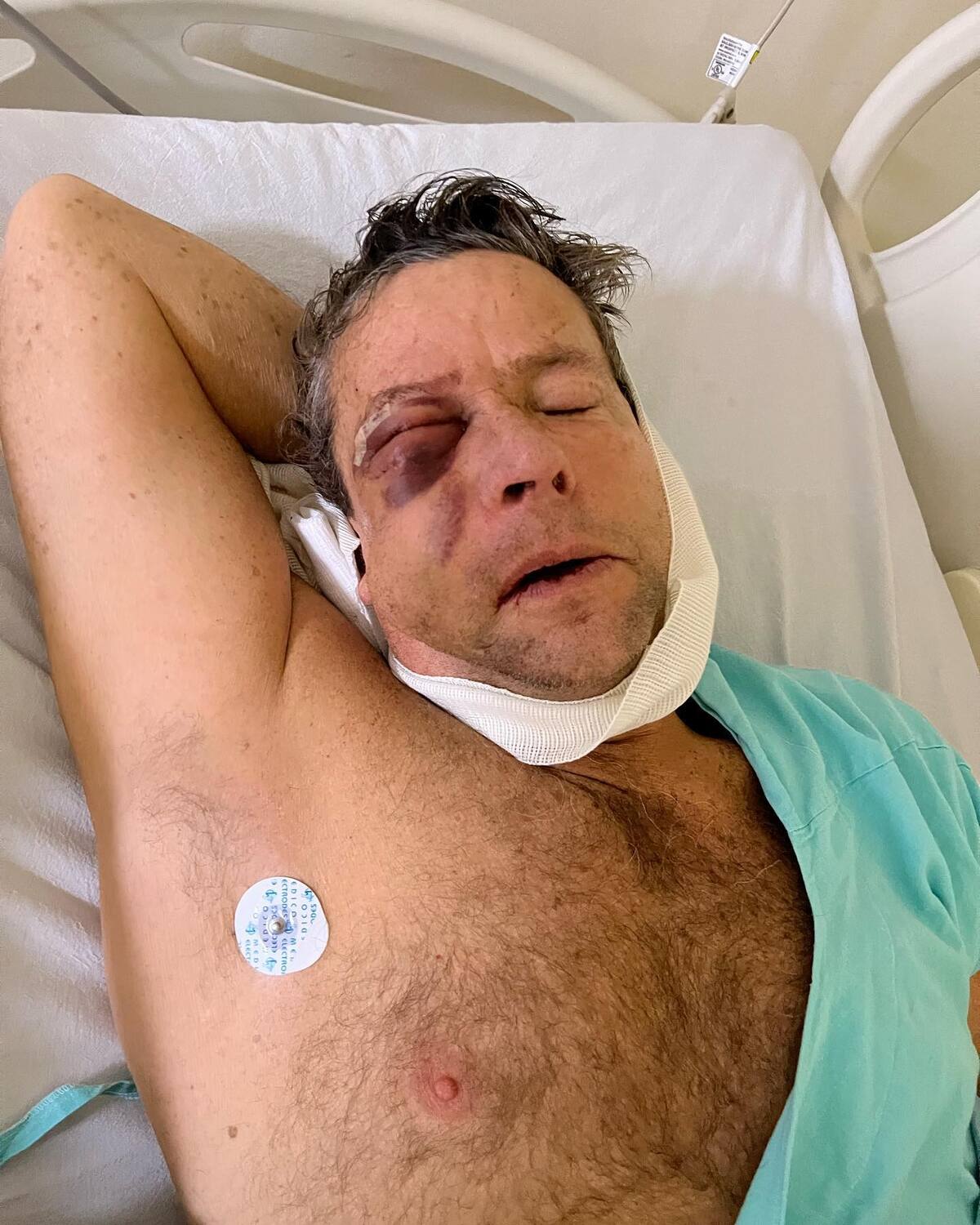 Alfredo Adame protagonizó otra pelea. El año pasado tuvo que ser intervenido por los daños que recibió en su ojo - Créditos: Facebook