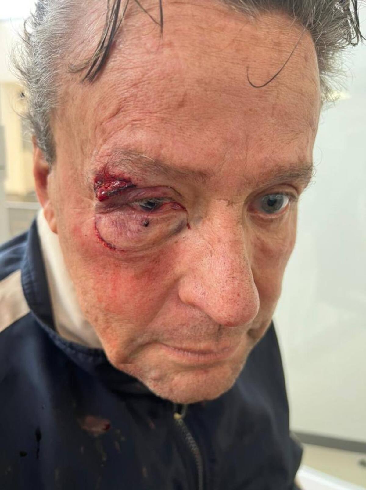 Alfredo Adame relata cómo se encuentra tras la golpiza de la que fue víctima - Créditos: Instagram