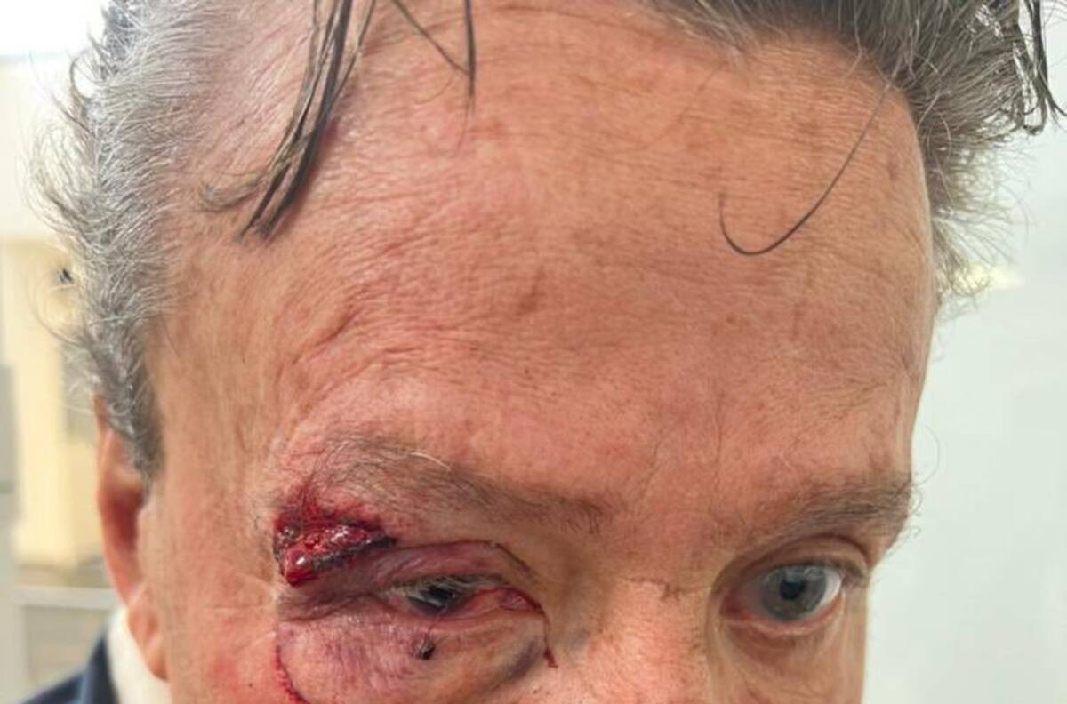 Alfredo Adame reaparece con complicado diagnóstico de salud tras golpiza