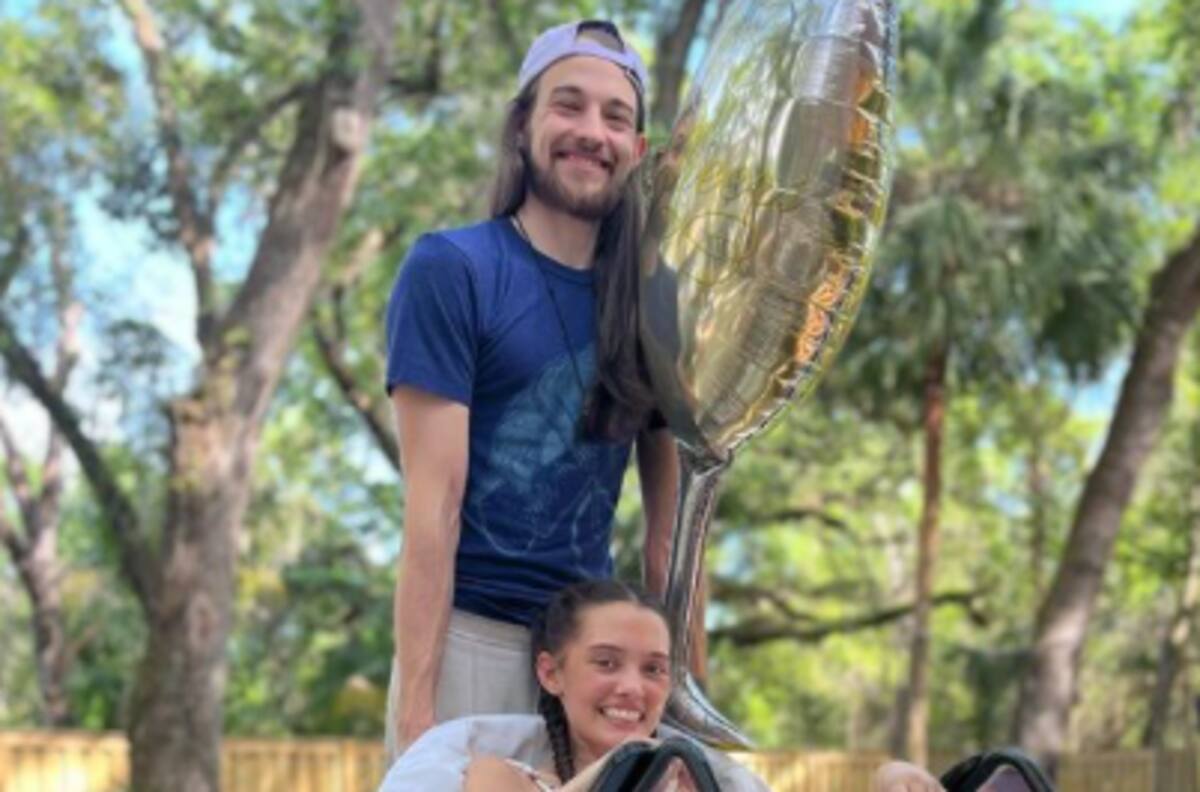 Amputan ambas piernas a modelo tras complicaciones de Covid-19