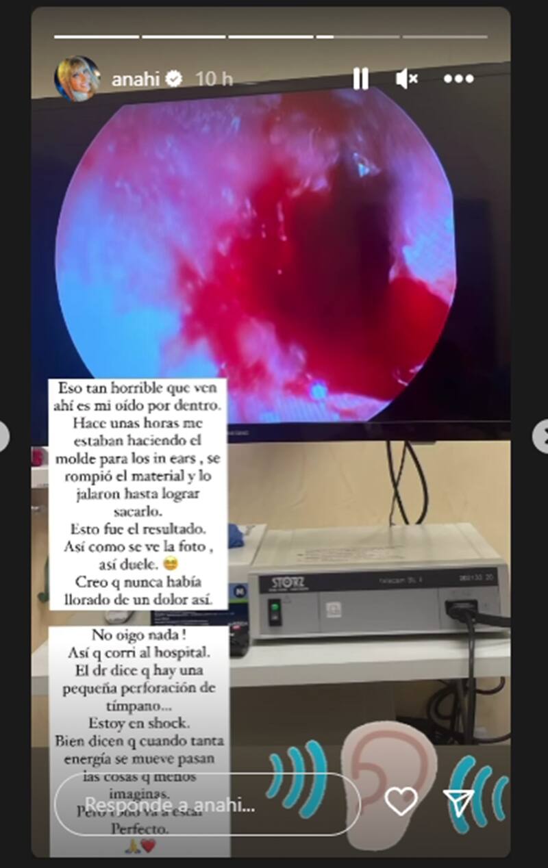 Anahí accidente oido