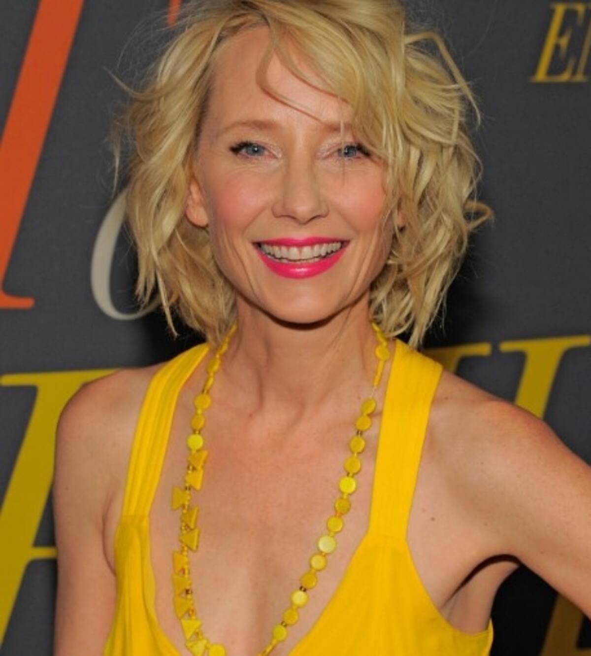 "Anne Heche será recordada por su valiente honestidad"; declaración no le da esperanzas de vida La actriz donó sus órganos. - Créditos: Instagram