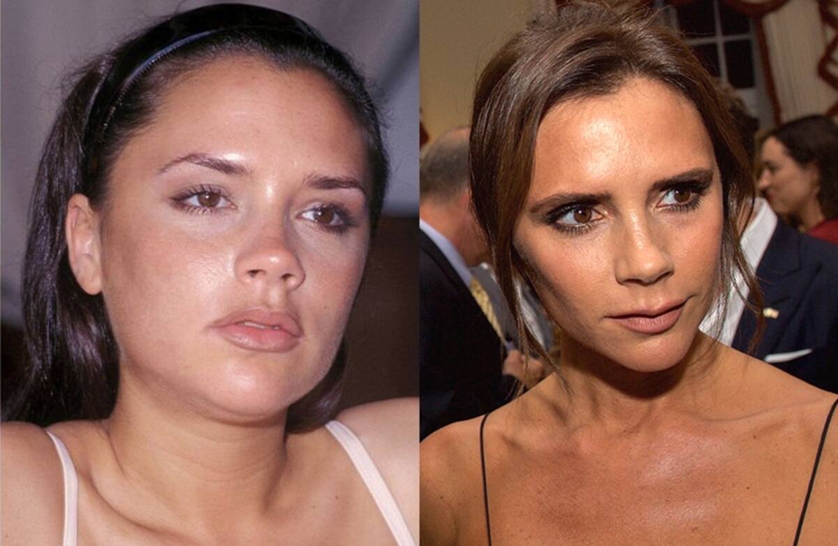 "Aprende a aceptar tus imperfecciones", fue el consejo de Victoria Beckham en relación a las intervenciones estéticas. - Créditos: Twitter