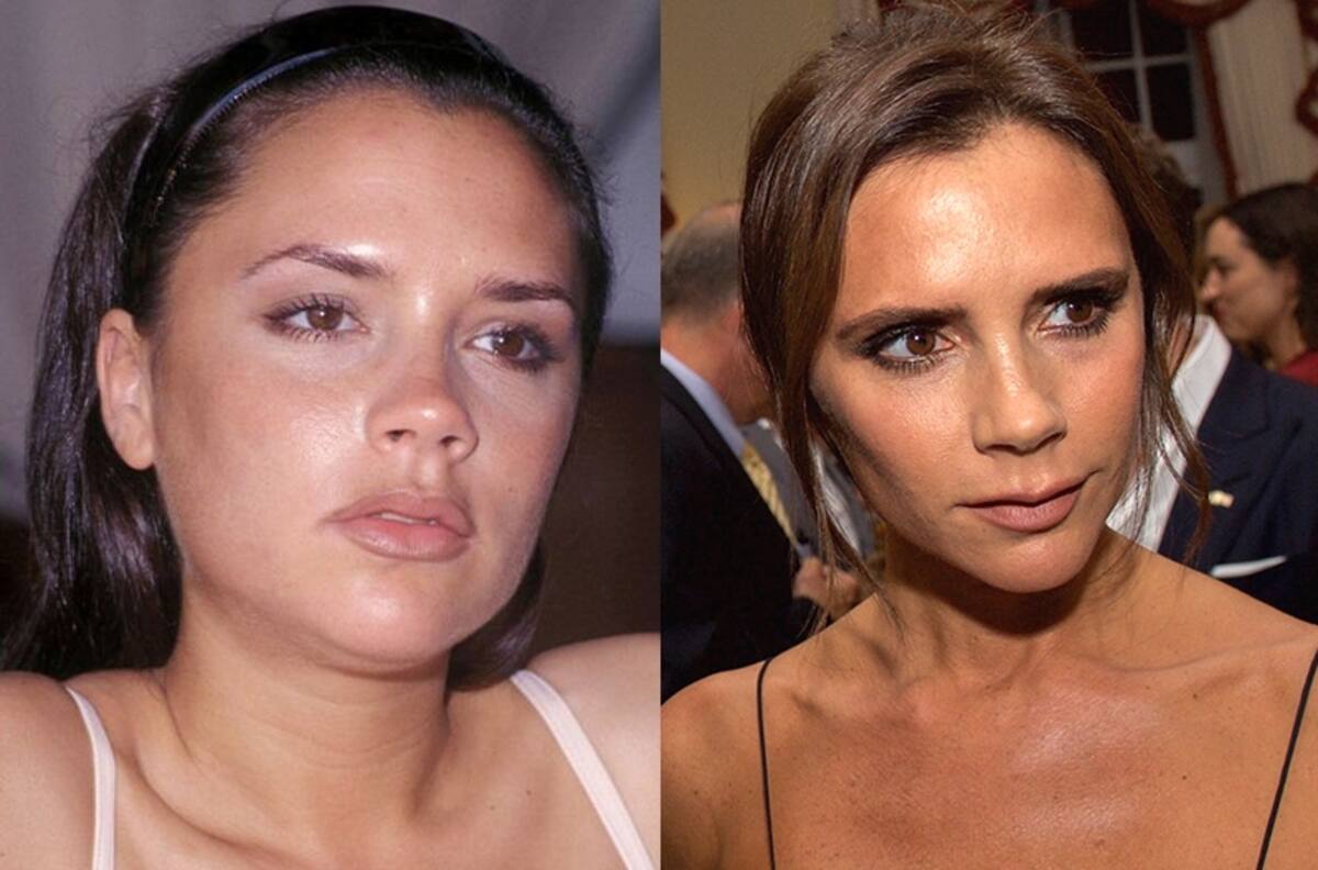 Los arreglos estéticos de los que Victoria Beckham hoy se arrepiente