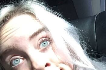 ¿Qué es el síndrome de Tourette y cómo ha afectado la vida de Billie Eilish?