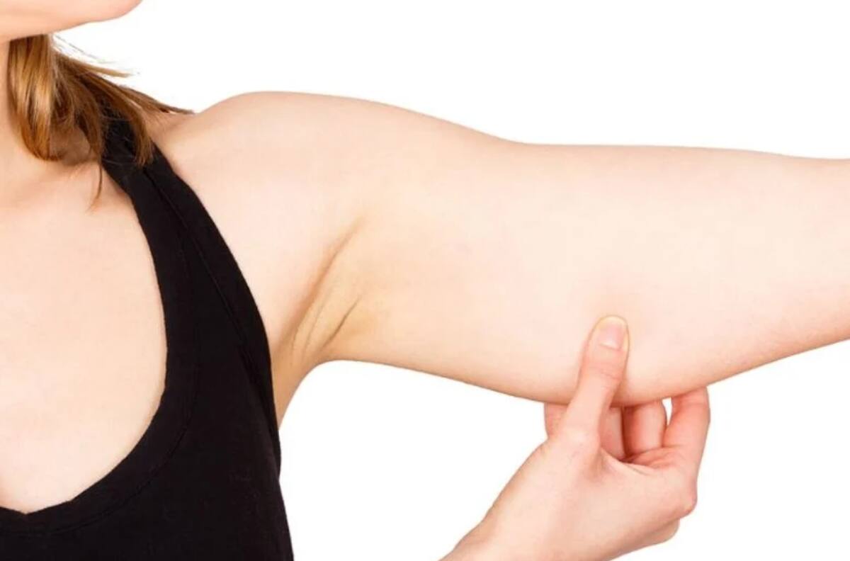 Bicarbonato: el aliado natural para solucionar las ‘alas de murciélago’