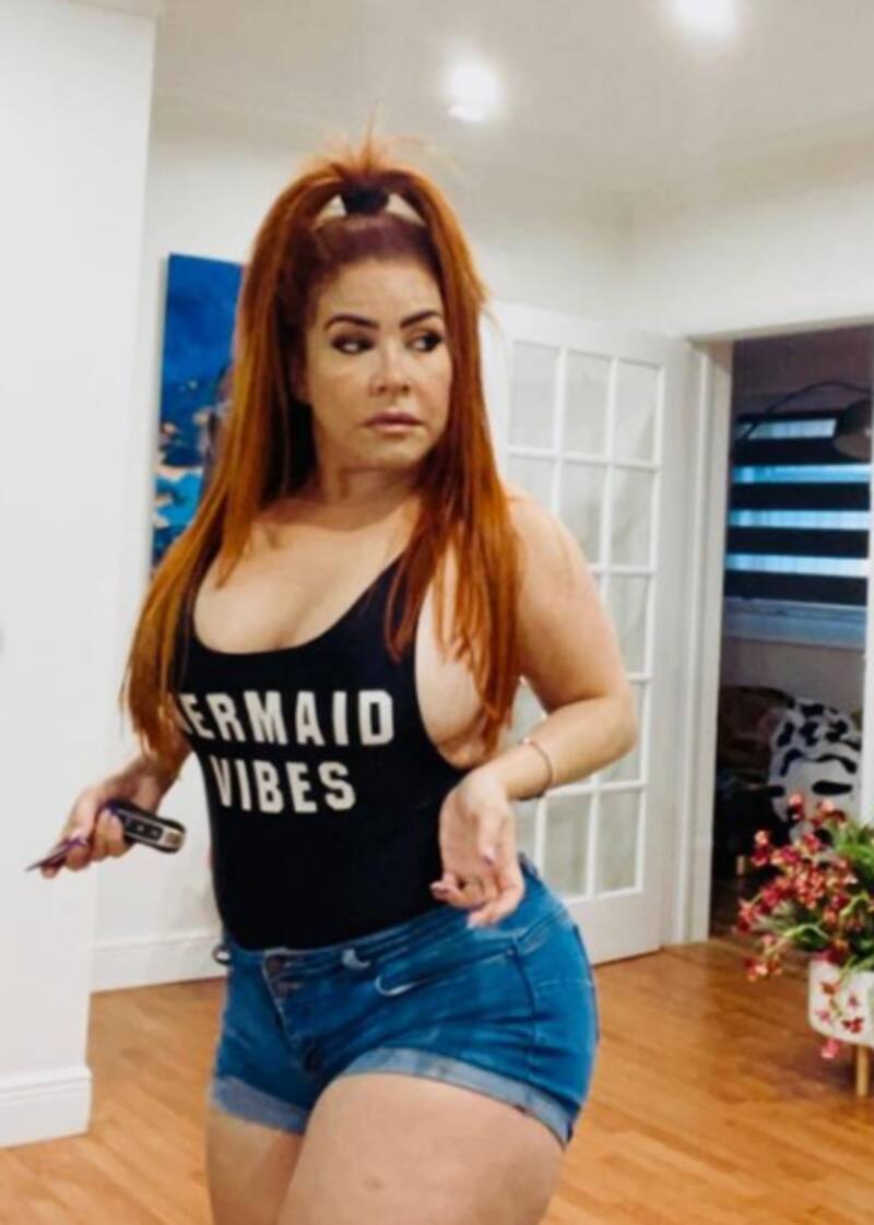 Carolina Sandoval se somete a cirugía - Créditos: Instagram