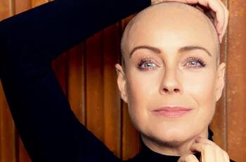 Claudia Conserva reaparece en conmovedora foto y cuenta cómo afronta su lucha contra el cáncer