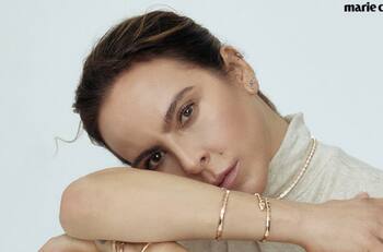 Así se veía Kate del Castillo antes de las cirugías que se realizó en el rostro