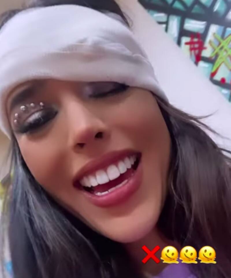 Danna Paola muestra el chichón que se hizo - Créditos: Instagram