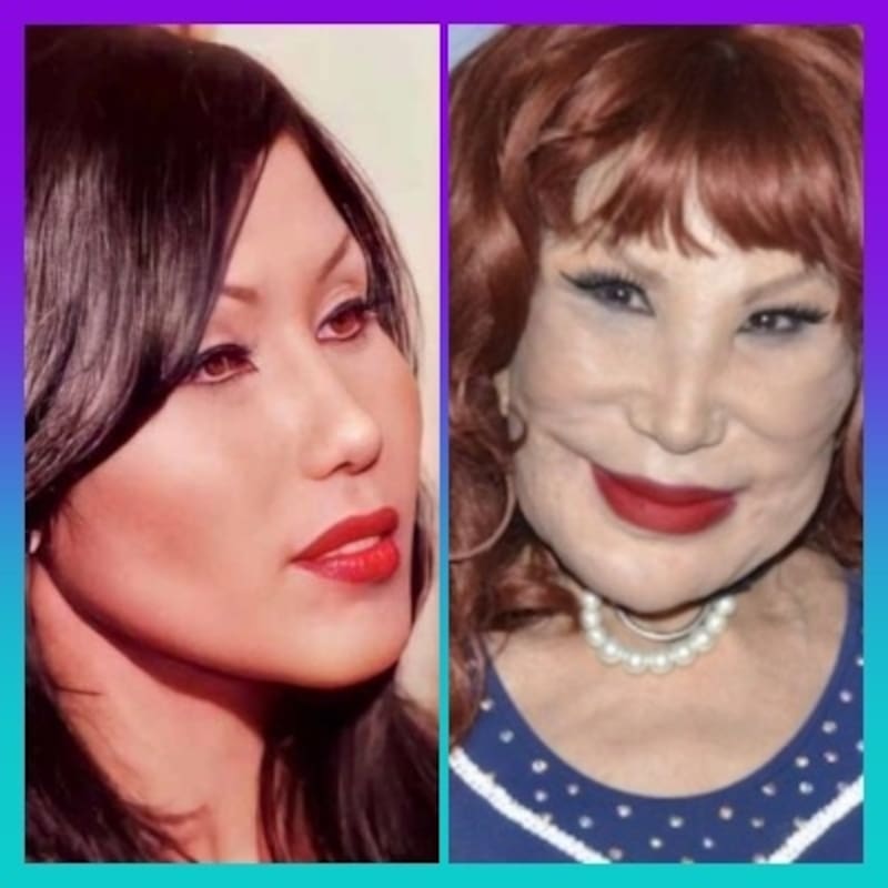 El antes y después de Lyn May - Créditos: Especial