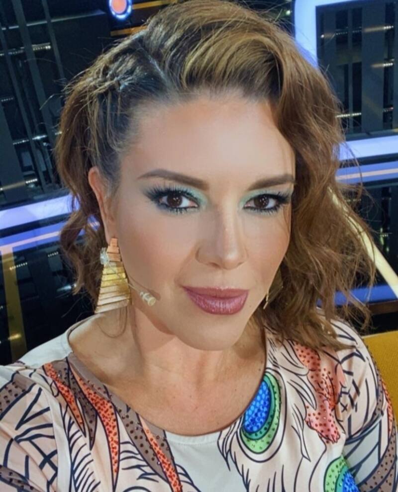 El doloroso proceso al que se sometió Alicia Machado para transformar su rostro - Créditos: Instagram