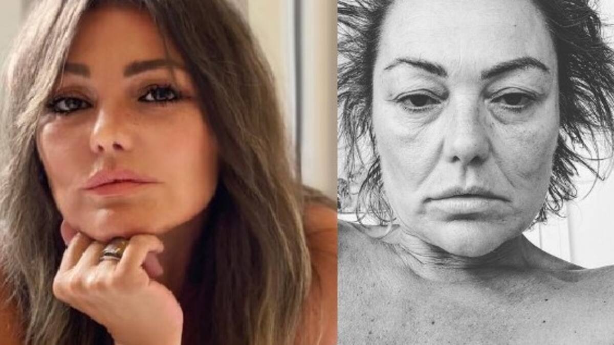 Ex cantante de La Oreja de Van Gogh deja en evidencia su mal estado