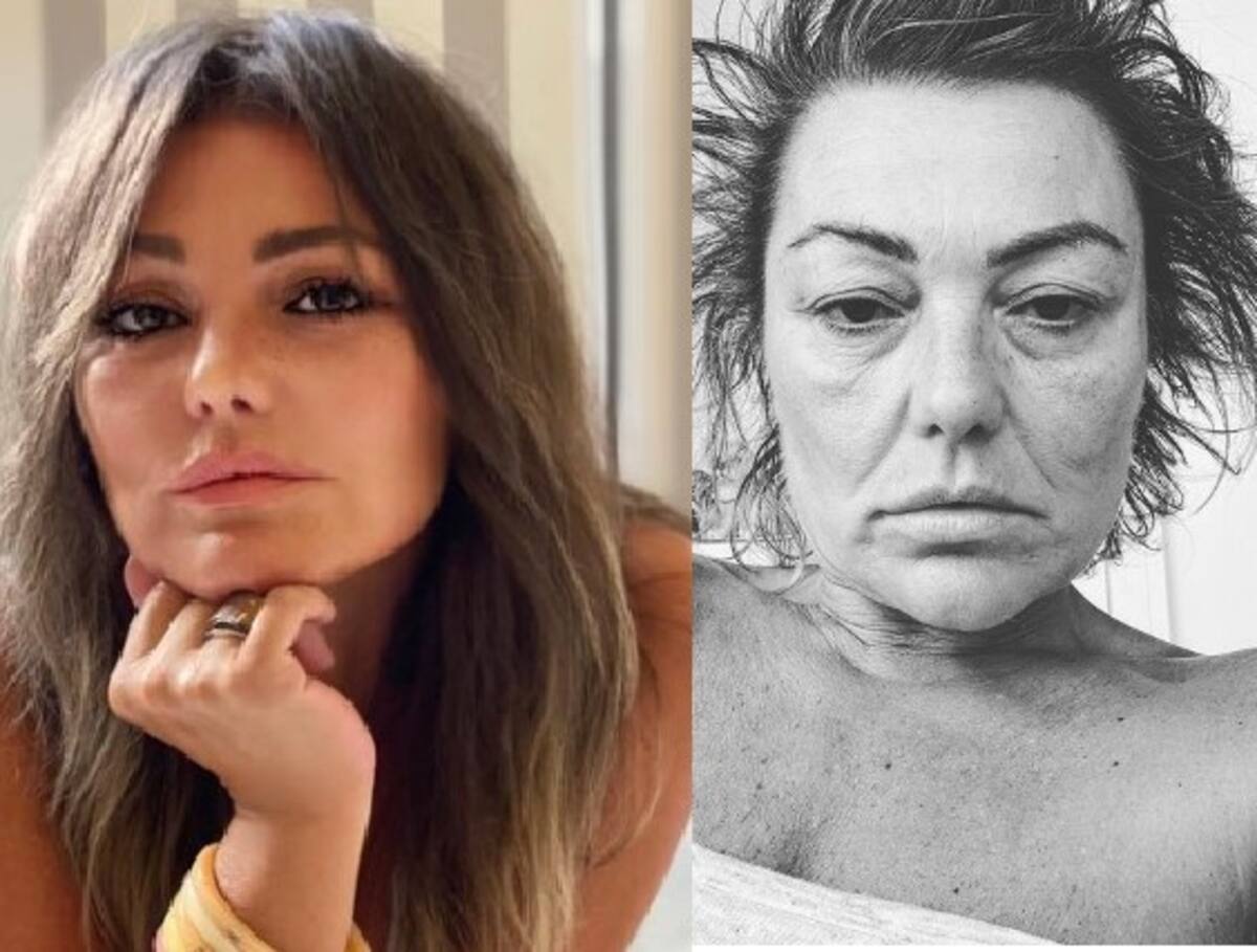 Ex cantante de La Oreja de Van Gogh deja en evidencia su mal estado Antes y hoy. La cantante no tenía un buen semblante este viernes - Créditos: Especial