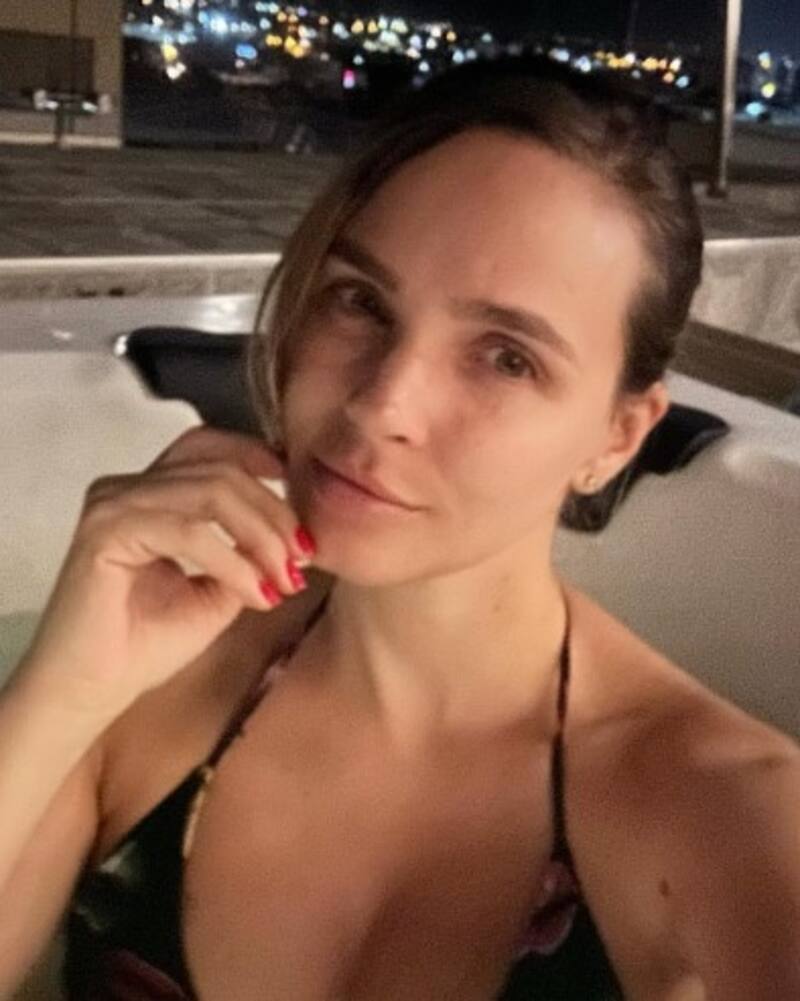 Ex reina colombiana Elizabeth Loaiza revela enorme cicatriz en su cuerpo por la que dará lucha legal La modelo está orientada en su combate contra los biopolímeros - Créditos: Instagram