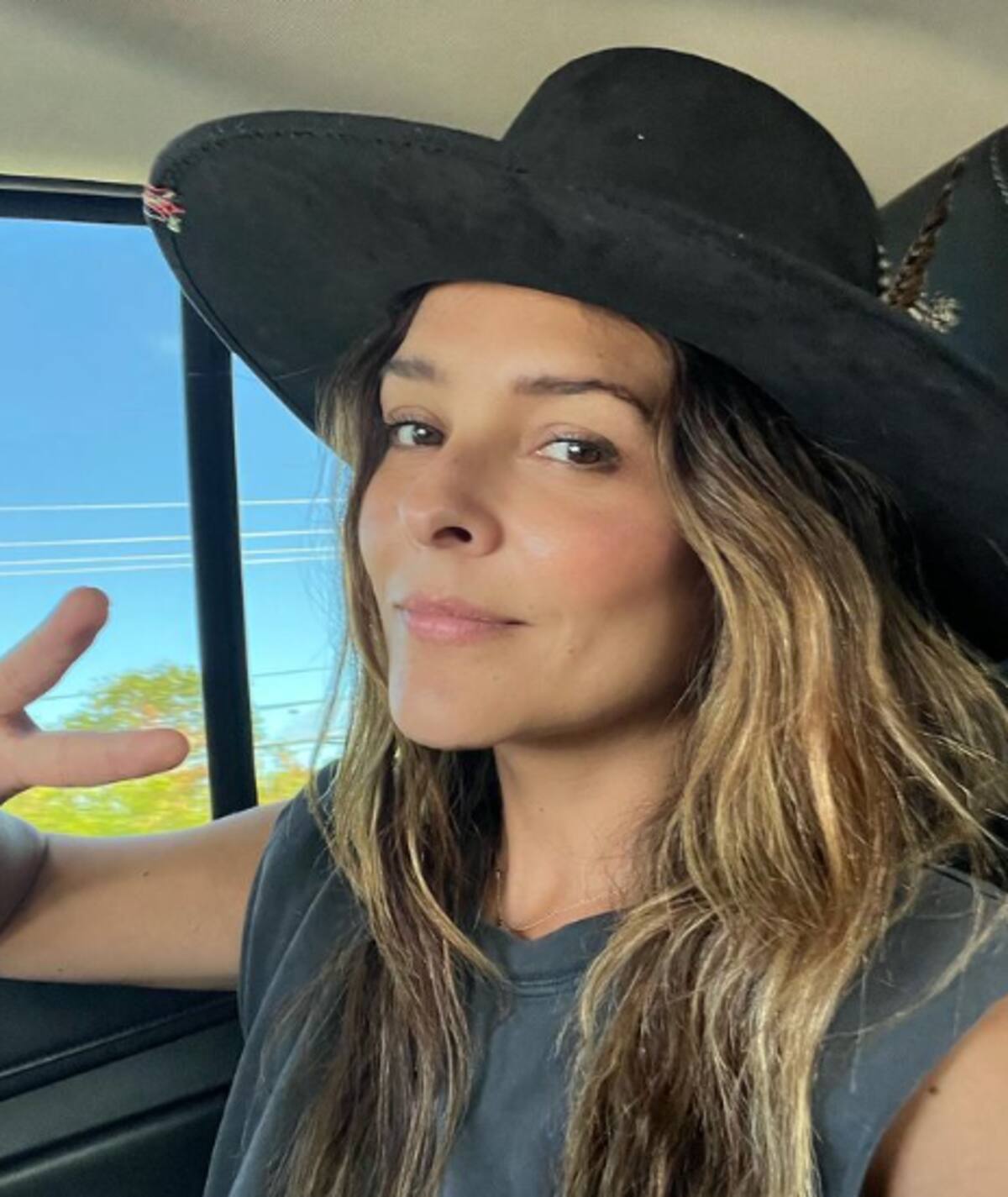 Grettell Valdez detalla el tratamiento que sigue tras perder parte de un dedo - Créditos: Instagram