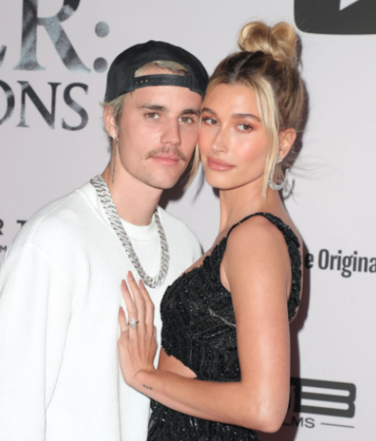 Hailey Bieber fue hospitalizada por una afección cerebral - Créditos: Instagram