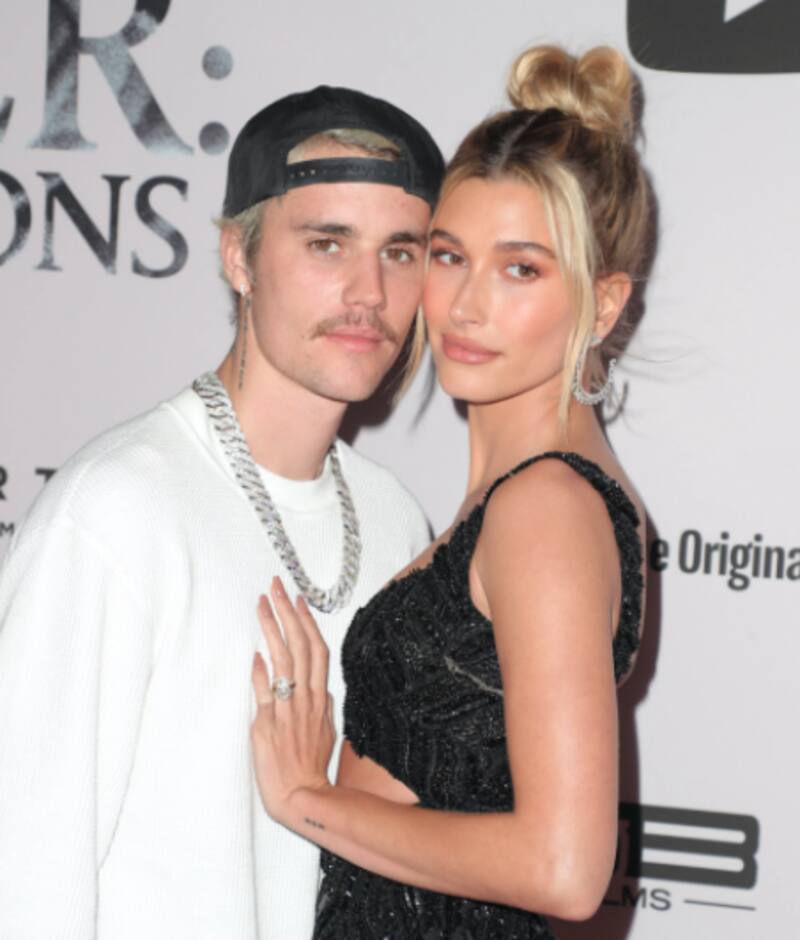 Hailey Bieber fue hospitalizada por una afección cerebral - Créditos: Instagram