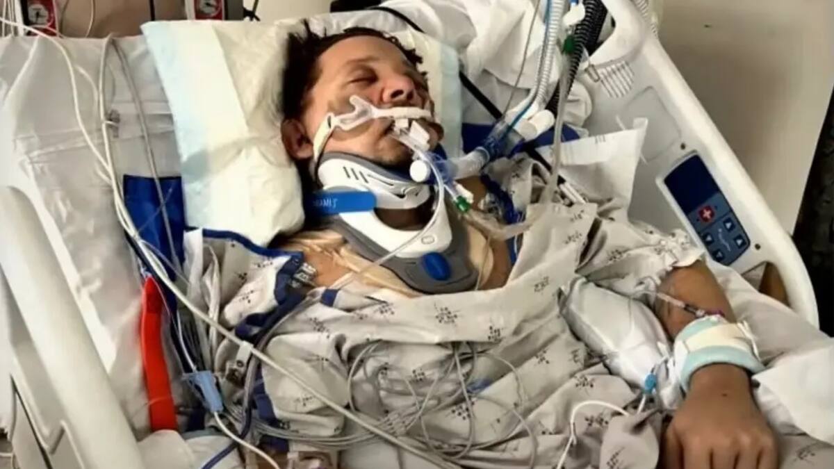 Jeremy Renner contó que el accidente lo dejó con uno ojo colgando de su rostro