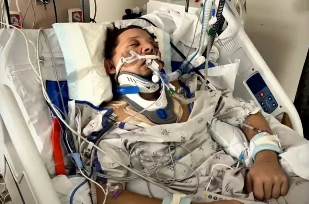 Jeremy Renner contó que el accidente lo dejó con uno ojo colgando de su rostro