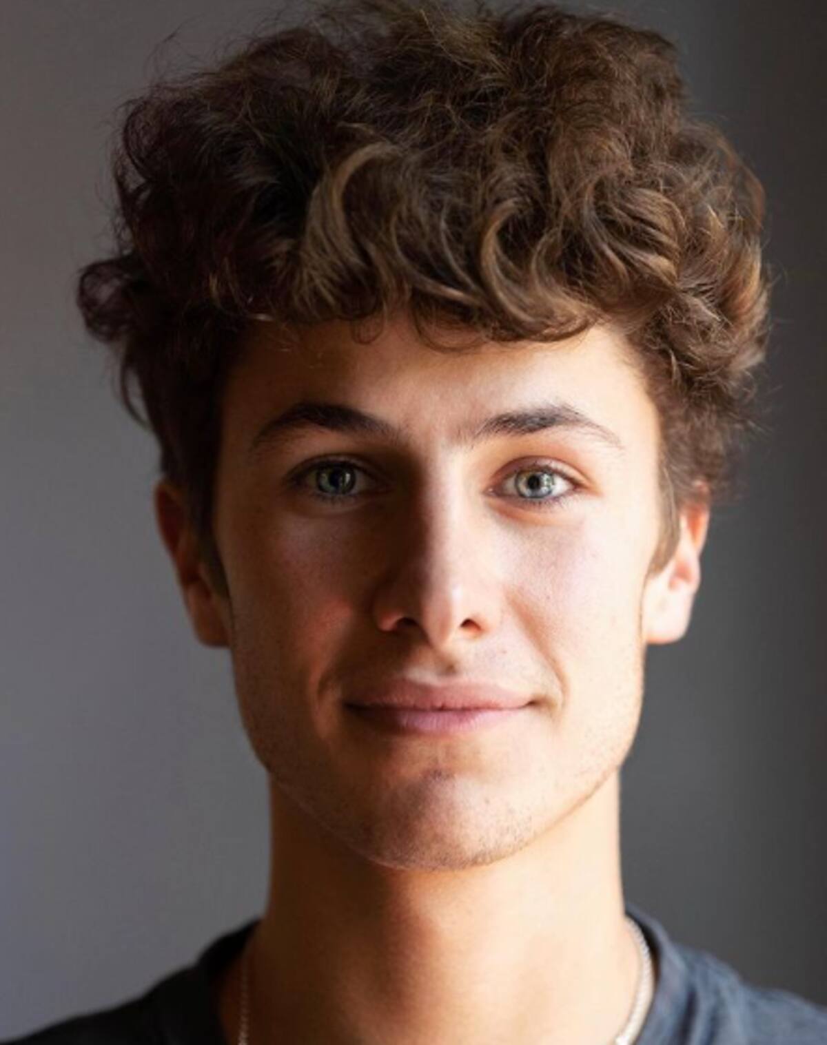 Juanpa Zurita se somete a cirugía plástica - Créditos: Instagram