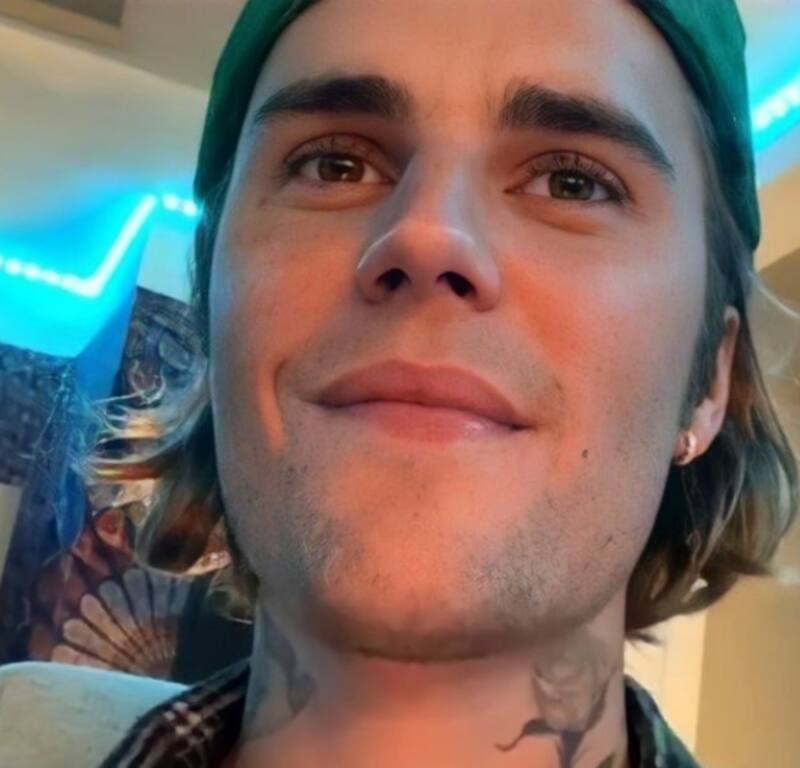Justin Bieber comparte cómo va su recuperación - Créditos: TWITTER