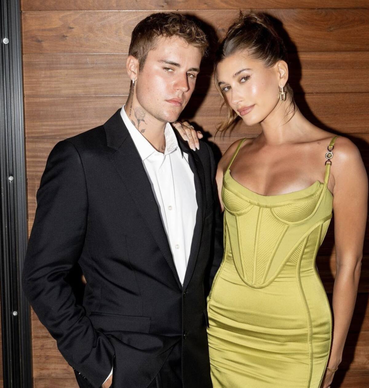 Justin Bieber tiene buenas noticias para sus fans tras la parálisis facial que sufrió - Créditos: Instagram