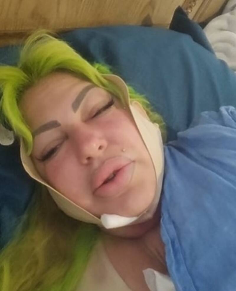 La Diosa de Cuba reaparece tras cirugía estética completa pero aún con problemas de movilidad En proceso de rehabilitación apareció la cantante - Créditos: Instagram