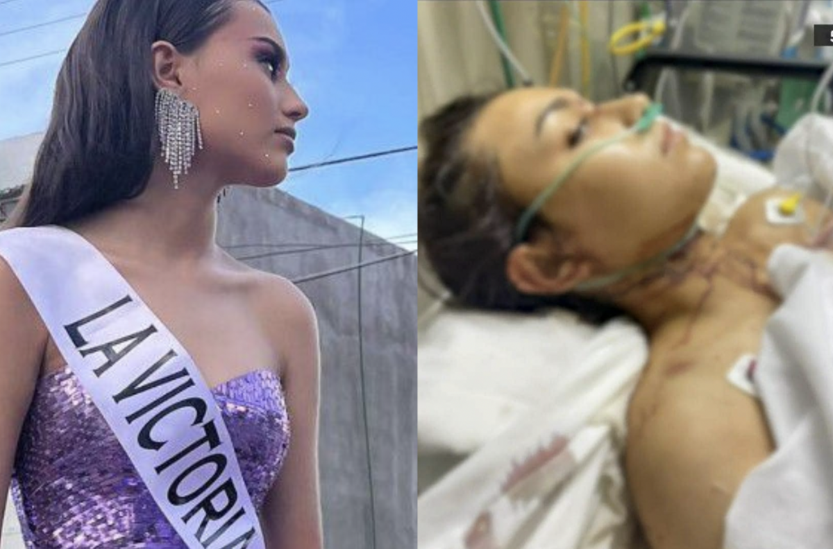 La reina de belleza que estuvo a punto de morir a manos de su ex pareja; recibió 47 puñaladas