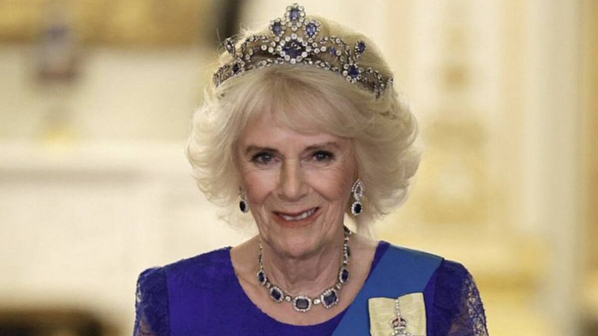 Los dolorosos procedimientos estéticos que se hizo la reina Camila para no dejarse opacar por Diana