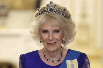 Los dolorosos procedimientos estéticos que se hizo la reina Camila para no dejarse opacar por Diana