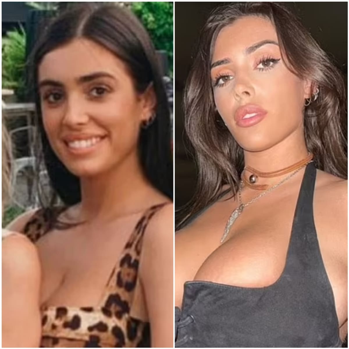 Las operaciones que se ha hecho la nueva esposa de Kanye West para parecerse a Kim Kardashian - Créditos: Instagram