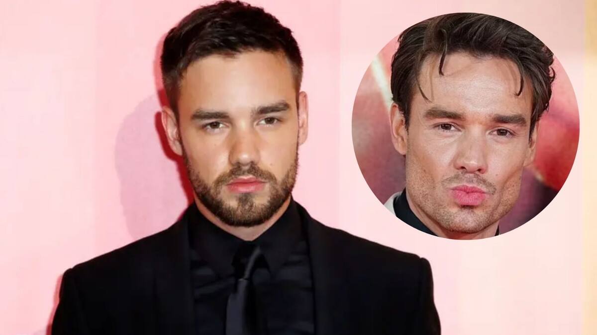 Ex integrante de One Direction impacta por drástico cambio en su rostro y luce irreconocible