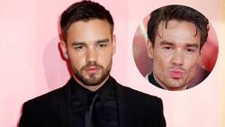 Ex integrante de One Direction impacta por drástico cambio en su rostro y luce irreconocible
