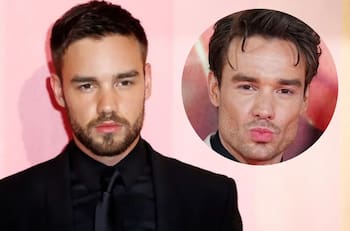 Ex integrante de One Direction impacta por drástico cambio en su rostro y luce irreconocible
