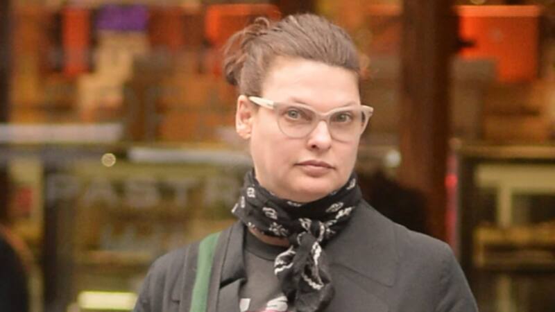 Linda Evangelista sufrió la desfiguración de su rostro Linda Evangelista sufrió la desfiguración de su rostro
- Créditos: Twitter