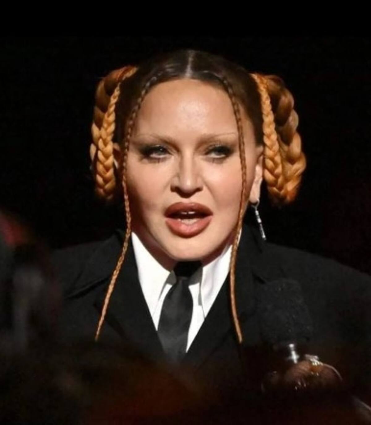 Madonna se lanza con todo contra las críticas a su rostro desfigurado e identifica a los culpables La artista dijo que seguirá luchando contra el patriarcado y la misoginia - Créditos: Twitter