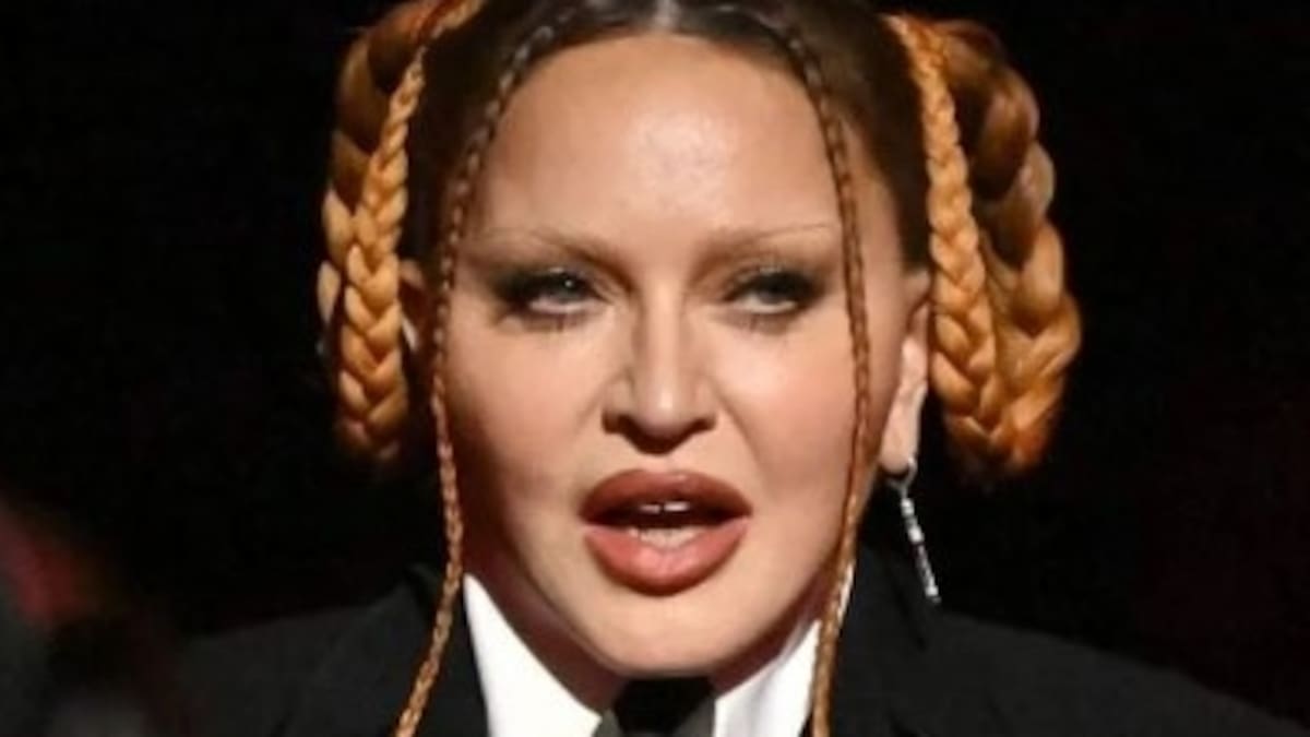 Madonna se lanza con todo contra las críticas a su rostro desfigurado e identifica a los culpables