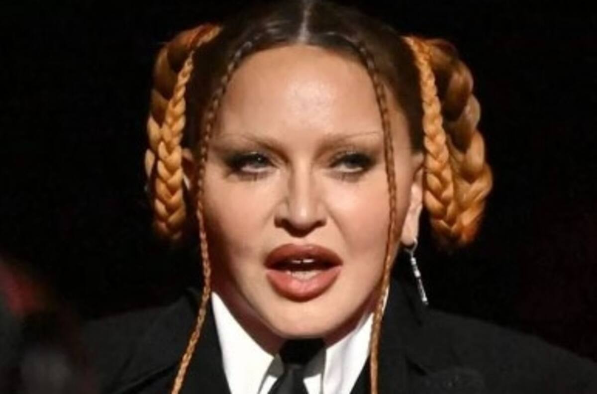 Madonna se lanza con todo contra las críticas a su rostro desfigurado e identifica a los culpables