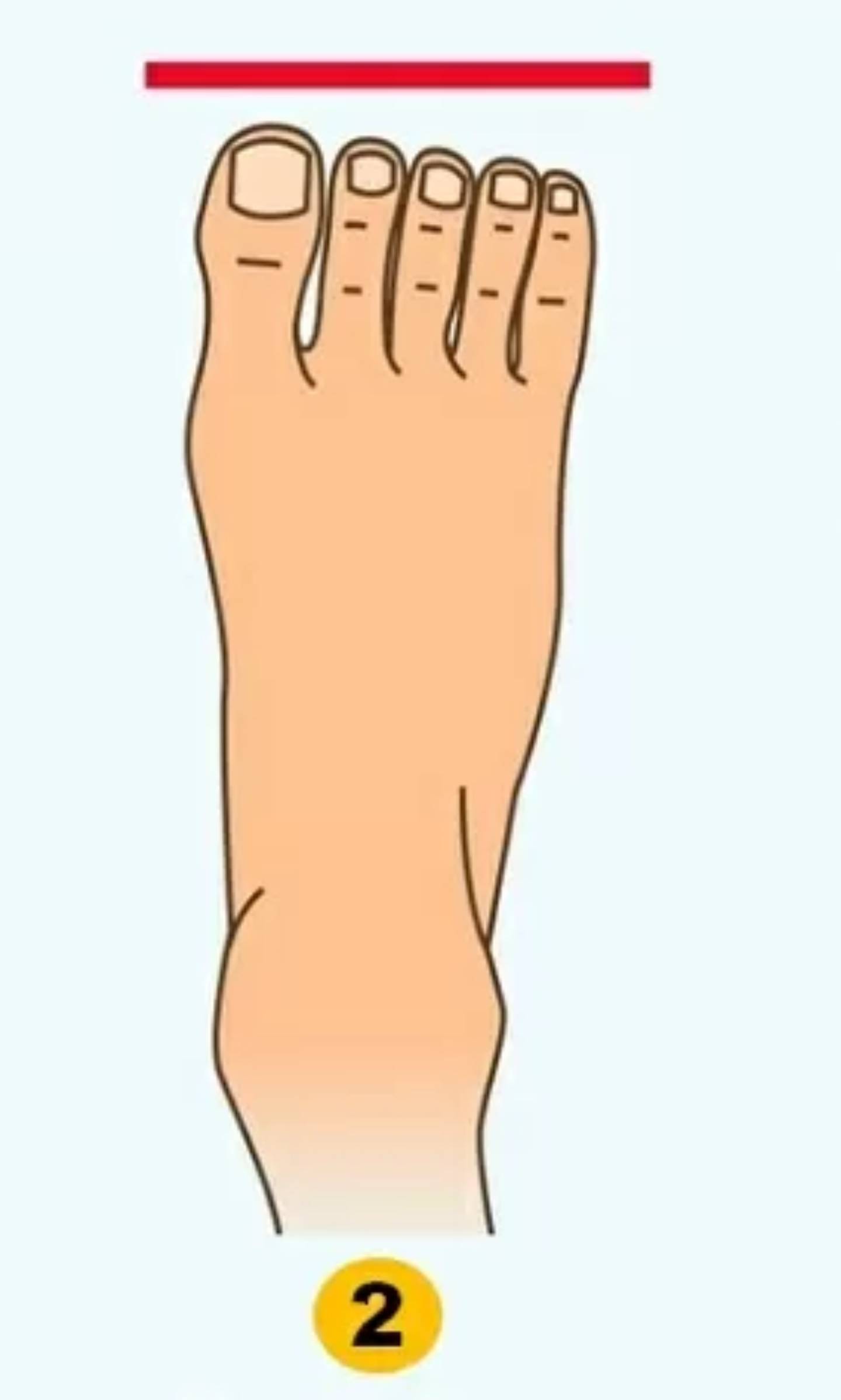 Ilustración de la forma de los pies.